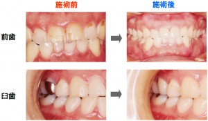 cosmetic_dentistry_img001