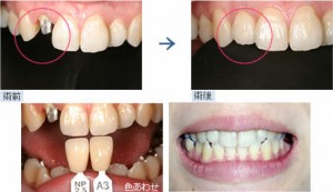 cosmetic_dentistry_img002