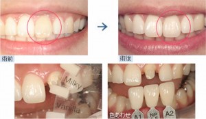 cosmetic_dentistry_img003