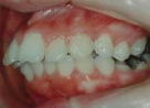 orthodontics_img001