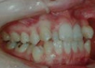 orthodontics_img002