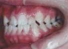 orthodontics_img003